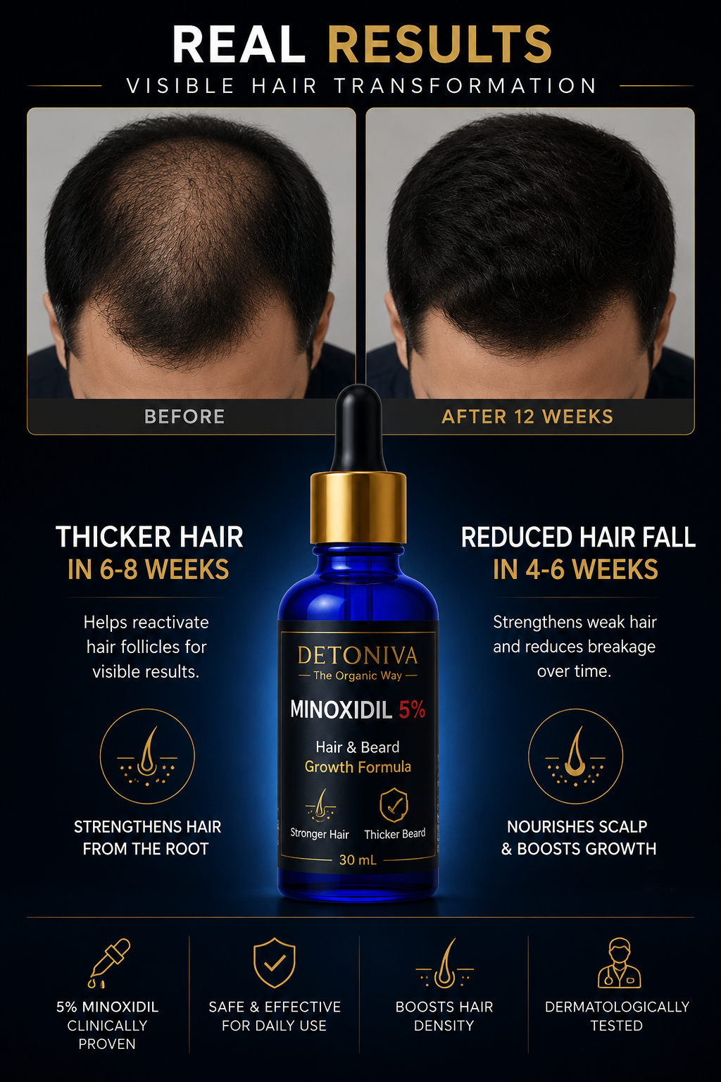 Minaxodil 5% Serum (Hair & Beard) Growth Formula