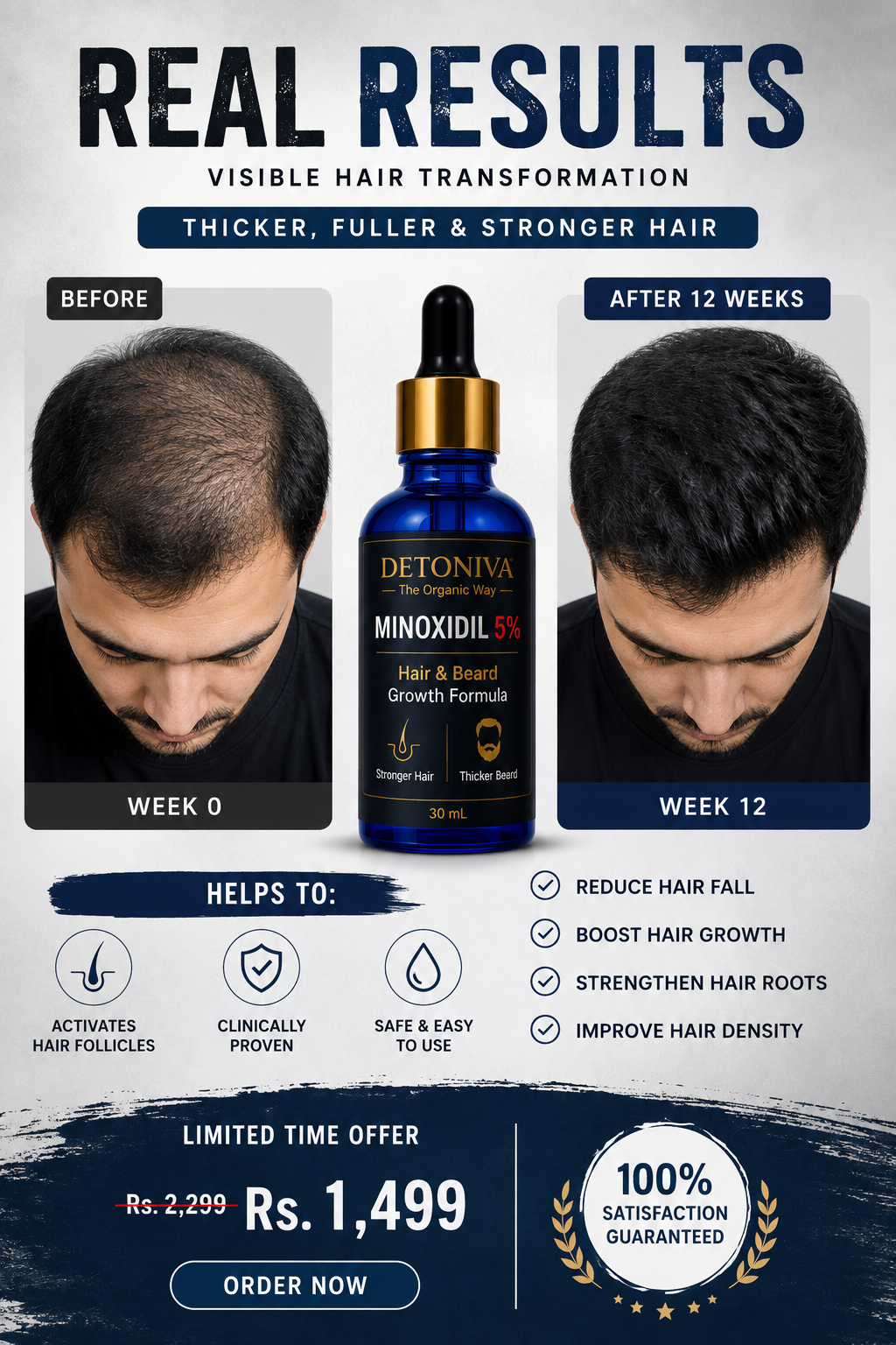 Minaxodil 5% Serum (Hair & Beard) Growth Formula